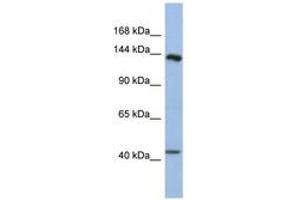Image no. 1 for anti-Slit Homolog 1 (SLIT1) (AA 1439-1488) antibody (ABIN6744315) (SLIT1 anticorps  (AA 1439-1488))