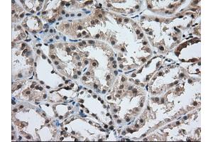 Immunohistochemical staining of paraffin-embedded Human prostate tissue using anti-USP5 mouse monoclonal antibody. (USP5 anticorps)