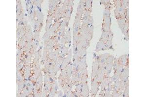 Immunohistochemistry of paraffin-embedded Rat heart using CD36 Polyclonal Antibody at dilution of 1:200 (40x lens). (CD36 anticorps)
