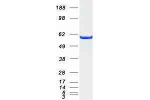 Validation with Western Blot