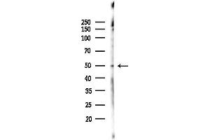 Western blot analysis of lysates from  cells(heat-shock,45 min treatment), using Phospho-SKP2/p45 (Ser64) Antibody at 1/1000 dilution.