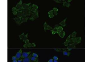 Immunofluorescence analysis of HeLa cells using Phospho-AKT(T308) Polyclonal Antibody at dilution of 1:100. (AKT1 anticorps  (pThr308))