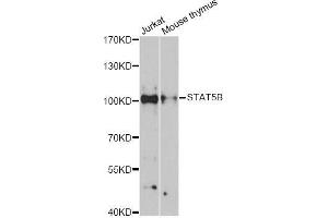 Western blot analysis of extracts of various cell lines, using STAT5B antibody (ABIN5998982) at 1:3000 dilution. (STAT5B anticorps)