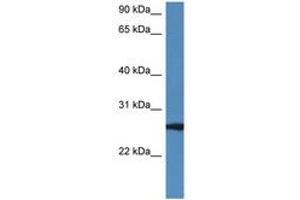Image no. 1 for anti-RAB27B, Member RAS Oncogene Family (RAB27B) (AA 122-171) antibody (ABIN6747242) (RAB27B anticorps  (AA 122-171))