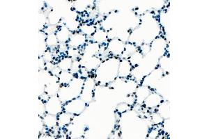 Immunohistochemistry of paraffin embedded mouse lung using UBE3A (ABIN7076104) at dilution of 1:1000 (400x lens) (ube3a anticorps)