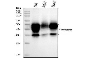 Western blot analysis of CD147/Emmprin using anti-CD147/Emmprin antibody (ABIN7599999). (CD147 anticorps  (AA 138-323))