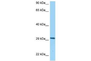 WB Suggested Anti-CD80 Antibody Titration: 1. (CD80 anticorps  (C-Term))