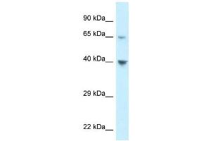Western Blot showing CCRL1 antibody used at a concentration of 1 ug/ml against 293T Cell Lysate (CCRL1 anticorps  (C-Term))