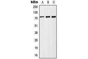 Western blot analysis of MX2 expression in HeLa (A), Raw264. (MX2 anticorps  (Center))