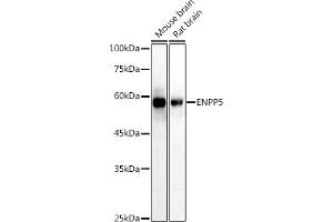 Western blot analysis of extracts of various cell lines, using (ABIN7266899) at 1:1000 dilution. (ENPP5 anticorps)