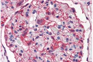 Human Kidney (formalin-fixed, paraffin-embedded) stained with NES antibody ABIN351499 at 5 ug/ml followed by biotinylated anti-mouse IgG secondary antibody ABIN481714, alkaline phosphatase-streptavidin and chromogen.