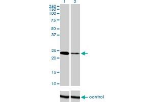 Western blot analysis of TWIST1 over-expressed 293 cell line, cotransfected with TWIST1 Validated Chimera RNAi (Lane 2) or non-transfected control (Lane 1). (TWIST1 anticorps  (AA 100-202))