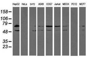 Image no. 2 for anti-Protein Disulfide Isomerase Family A, Member 4 (PDIA4) antibody (ABIN1500106) (PDIA4 anticorps)