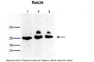 WB Suggested Anti-RAB26 Antibody Titration: 0.