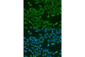 Immunofluorescence analysis of U2OS cells using RPS27A antibody. (RPS27A anticorps  (AA 1-156))