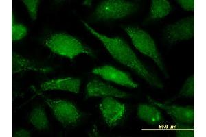 Immunofluorescence of monoclonal antibody to ALG6 on HeLa cell.