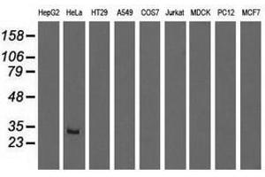 Image no. 1 for anti-Glutathione S-Transferase theta 2 (GSTT2) antibody (ABIN1498559) (GSTT2 anticorps)