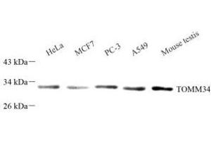 Western blot analysis of TOMM34 (ABIN7075984) at dilution of 1: 1000 (TOMM34 anticorps)