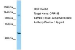 Image no. 1 for anti-G Protein-Coupled Receptor 158 (GPR158) (AA 1120-1169) antibody (ABIN6750189) (GPR158 anticorps  (AA 1120-1169))