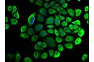 Immunofluorescence staining of Hela cells with ABIN7147101 at 1:33, counter-stained with DAPI.