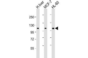 All lanes : Anti-RSBN1 Antibody (N-term) at 1:2000 dilution Lane 1: human liver lysate Lane 2: MCF-7 whole cell lysate Lane 3: HL-60 whole cell lysate Lysates/proteins at 20 μg per lane. (RSBN1 anticorps  (N-Term))