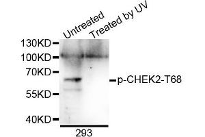 Western blot analysis of extracts of 293 cells, using Phospho-CHEK2-T68 antibody. (CHEK2 anticorps  (pThr68))