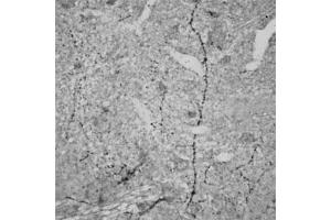 IHC on rat brain (paraffin sections) using Rabbit antibody to RhoA   at a concentration of 15 µg/ml, incubated overnight and developed with DAB Ni. (RHOA anticorps  (AA 100-150))