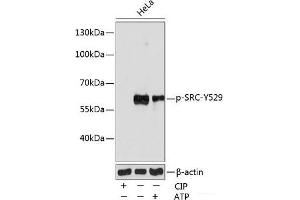 Western blot analysis of extracts of various cell lines using Phospho-SRC(Y529) Polyclonal Antibody at dilution of 1:1000. (Src anticorps  (pTyr529))