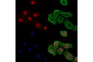 ABIN6254871 and ABIN6274016 staining Hela cells(heat shock treatment) by IF/ICC. (Histone H2A anticorps  (H2AK9ac))