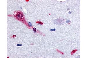 Anti-TAAR1 antibody IHC of human brain, amygdala. (TAAR1 anticorps  (Cytoplasmic Domain))