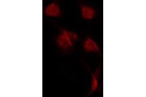 ABIN6275656 staining LOVO by IF/ICC. (USP42 anticorps  (Internal Region))