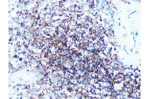 Immunohistochemistry of paraffin-embedded human spleen using CD20 Rabbit mAb (ABIN7268472) at dilution of 1:100 (40x lens). (CD20 anticorps)