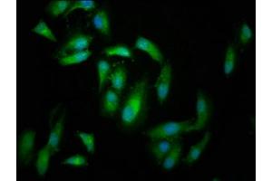 Immunofluorescence staining of Hela cells with ABIN7152702 at 1:166, counter-stained with DAPI.