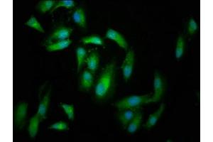 Immunofluorescence staining of Hela cells with ABIN7152702 at 1:166, counter-stained with DAPI. (FERMT2 anticorps  (AA 155-232))