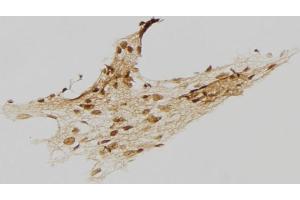 ABIN6273458 at 1/100 staining Human gastric tissue by IHC-P. (CENPI anticorps  (Internal Region))