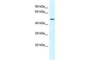 Image no. 1 for anti-Vitamin D-Binding Protein (GC) (AA 70-119) antibody (ABIN6747593) (Vitamin D-Binding Protein anticorps  (AA 70-119))