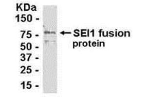 Western Blotting (WB) image for anti-SERTA Domain Containing 1 (SERTAD1) (AA 1-236) antibody (ABIN2468083) (SERTAD1 anticorps  (AA 1-236))
