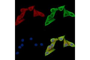 ABIN7095240 and ABIN7099297 staining Hela cells by IF/ICC. (NEXN anticorps)