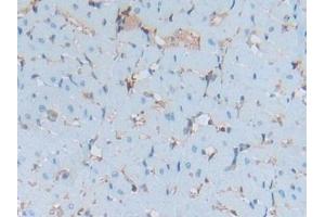 DAB staining on IHC-P; Samples: Rat Heart Tissue (S100A6 anticorps  (AA 1-89))