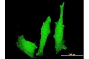 Immunofluorescence of monoclonal antibody to LMO4 on HeLa cell.