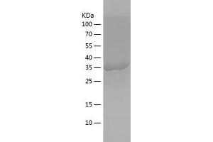 Western Blotting (WB) image for Acetyl-CoA Carboxylase alpha (ACACA) (AA 2223-2346) protein (His-IF2DI Tag) (ABIN7121644)