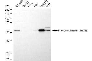 Western blotting analysis using phospho-vimentin (Ser72) antibody (ABIN7800835).
