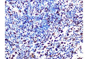 Immunohistochemistry of paraffin-embedded human appendix using S Rabbit mAb (ABIN7270142) at dilution of 1:100 (40x lens). (SAMHD1 anticorps)