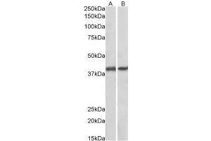 AP23750PU-N GNAQ antibody staining of Pig Colon (A) and Pig Spleen (B) lysates at 0. (GNAQ anticorps  (Internal Region))
