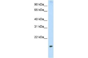 WB Suggested Anti-PPP1R8 Antibody Titration:  2. (PPP1R8 anticorps  (Middle Region))