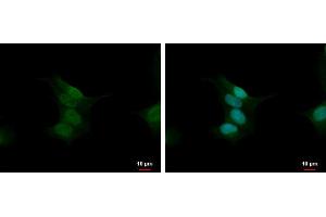 ICC/IF Image Calcineurin A antibody detects Calcineurin A protein at nucleus by immunofluorescent analysis. (Calcineurin A anticorps  (Center))