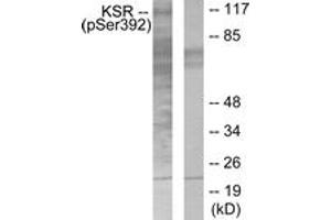 Western blot analysis of extracts from HepG2 cells, using KSR (Phospho-Ser392) Antibody. (KSR1 anticorps  (pSer404))