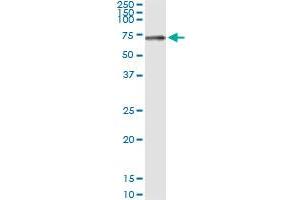 Immunoprecipitation of STK33 transfected lysate using anti-STK33 MaxPab rabbit polyclonal antibody and Protein A Magnetic Bead , and immunoblotted with STK33 purified MaxPab mouse polyclonal antibody (B01P) .
