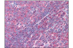Human Tonsil: Formalin-Fixed, Paraffin-Embedded (FFPE) (FNBP1 anticorps  (Internal Region))