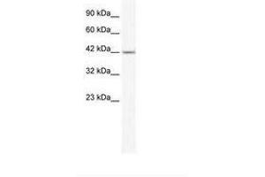 Image no. 2 for anti-Zinc Finger Protein 70 (ZNF70) (AA 119-168) antibody (ABIN202542)